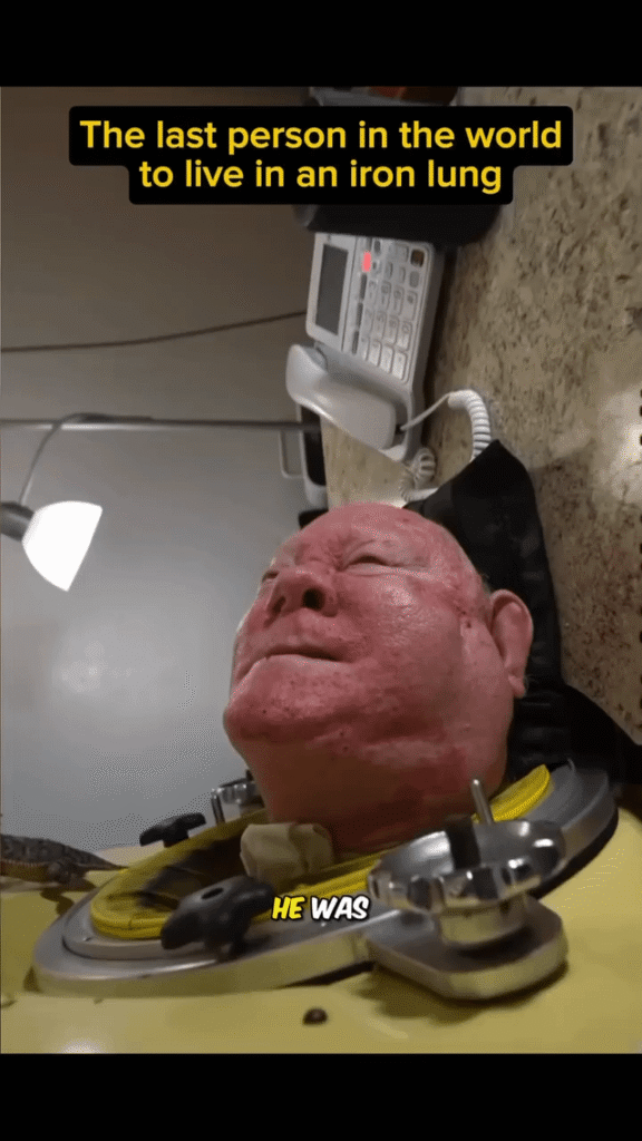 Paul Alexander, the last man in the world to live in an Iron lung.