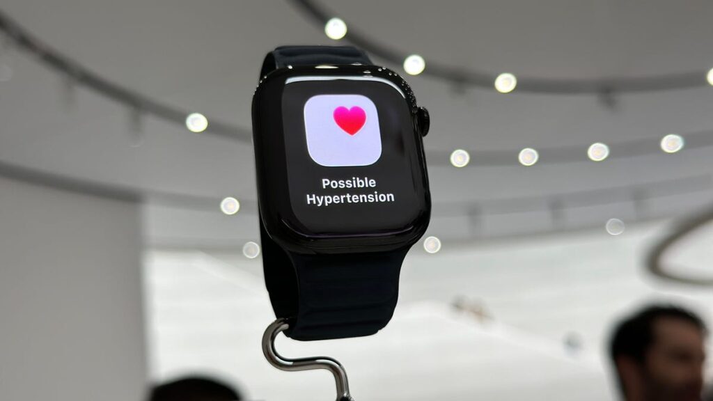 Apple Watch Series 11 on display on a stand among people.