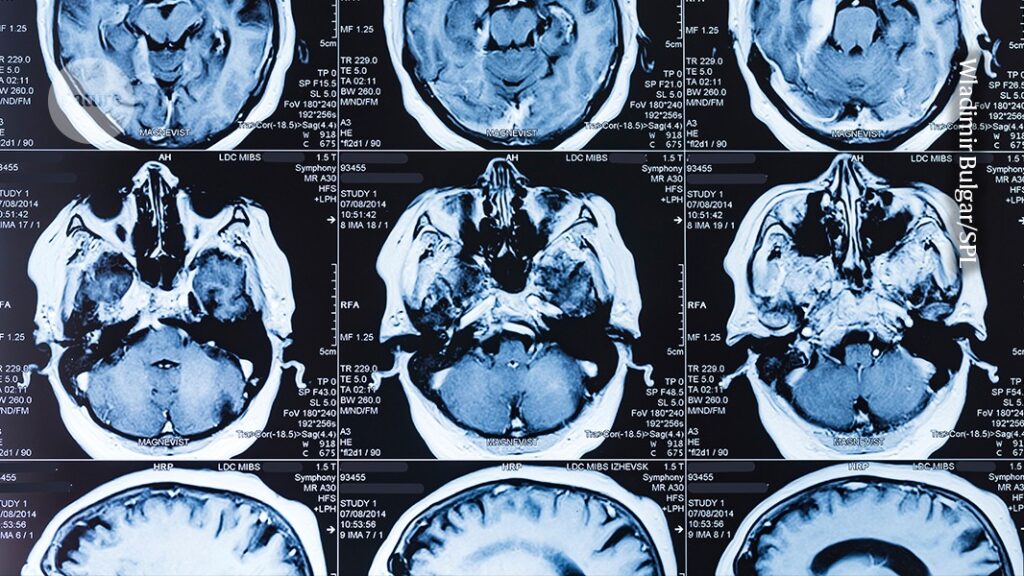 breakthroughs that show why fundamental research must be protected