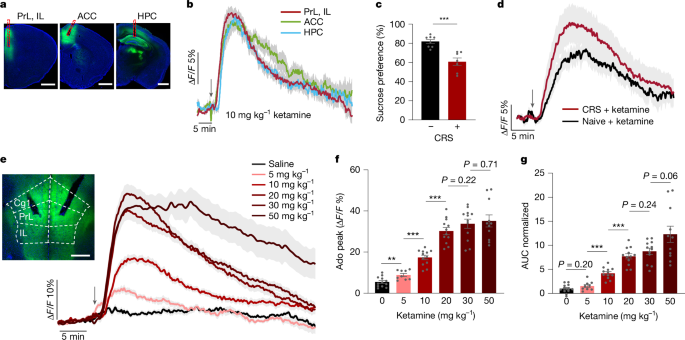 Adenosine signalling drives antidepressant actions of ketamine and ECT