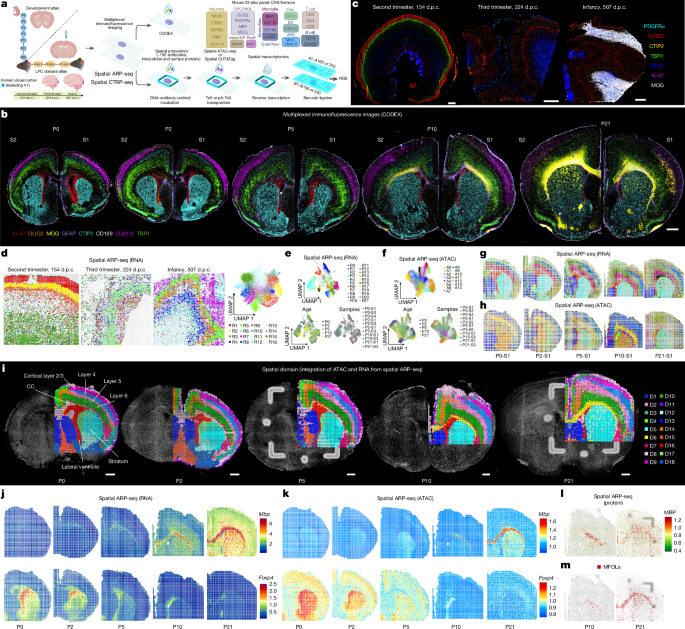 Spatial dynamics of brain development and neuroinflammation
